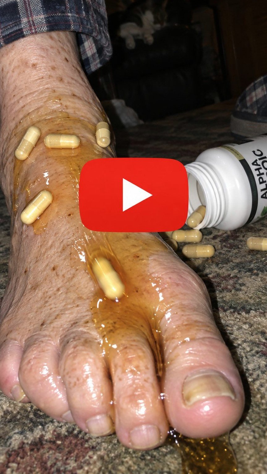 An older man's foot with alpha lipoic acid capsules spilled across it
